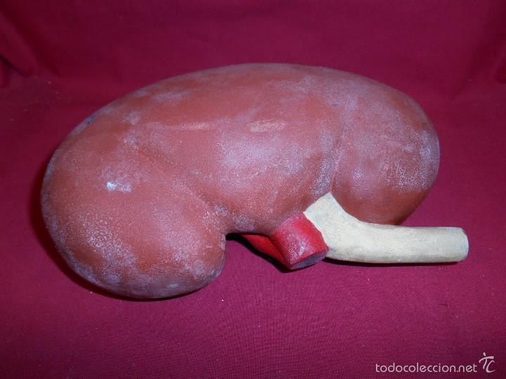 antiguo modelo anatomico del riñon humano - año - Compra venta en  todocoleccion