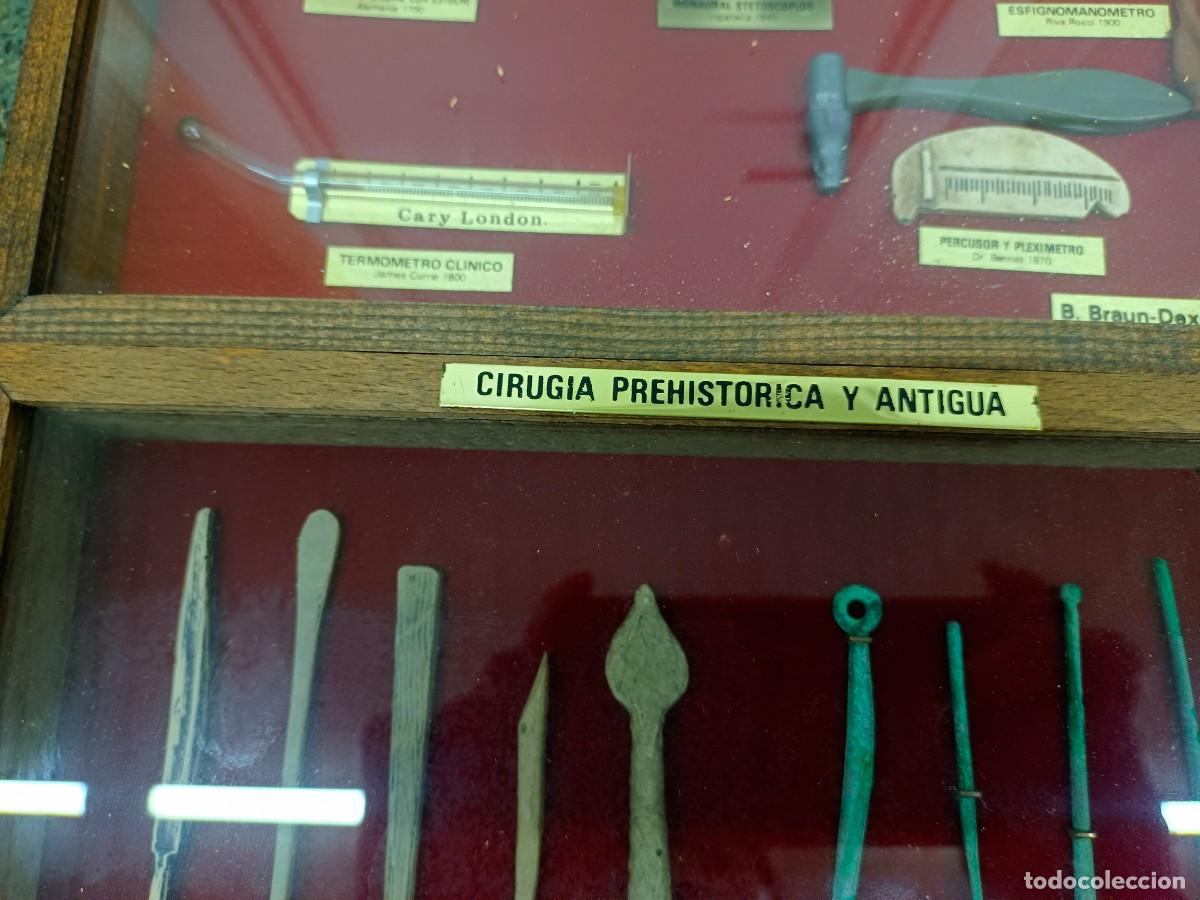 Antig&uuml;edades: Instrumentos cirug&iacute;a prehistorica - Foto 5