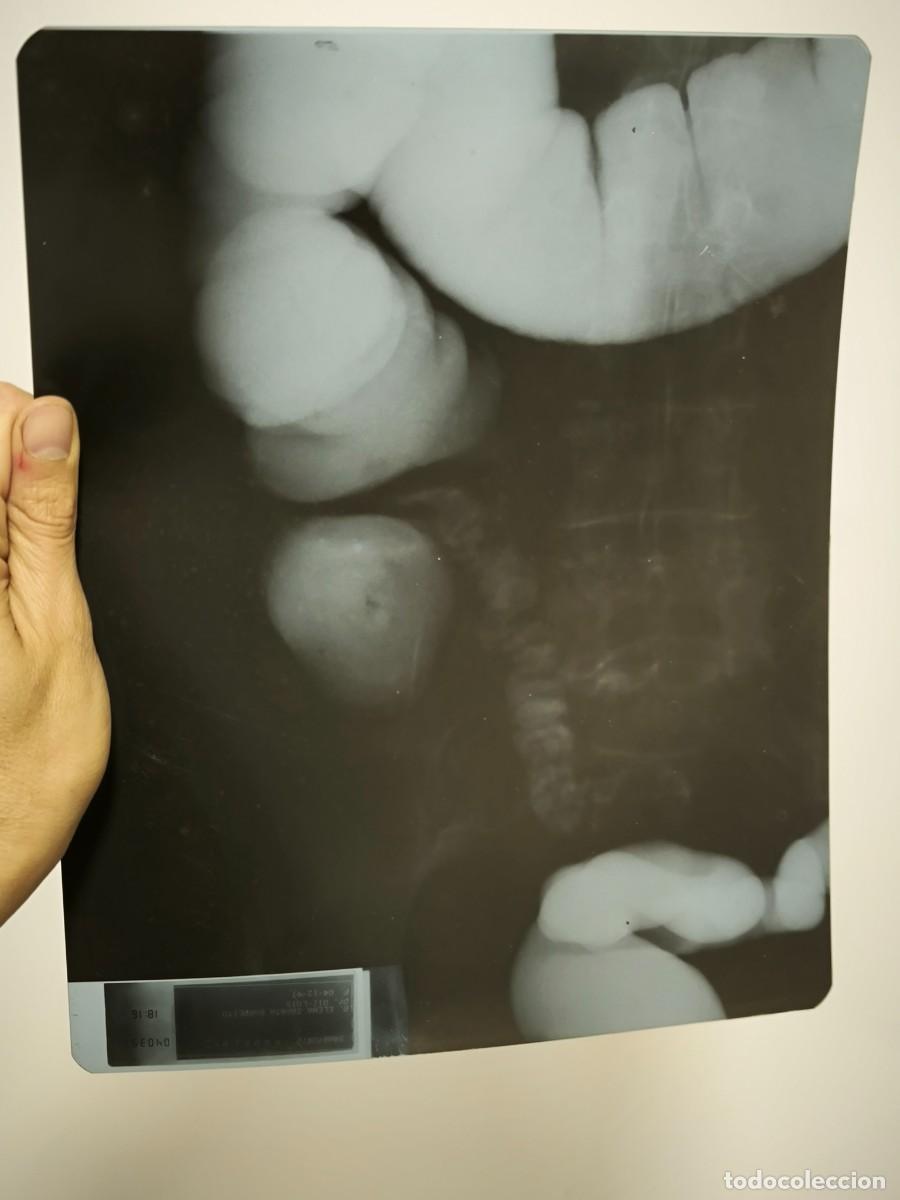 Antiquit&auml;ten: Radiograf&iacute;a M&eacute;dica Antigua Abdomen 30 X 24 Cm &ndash; Placa Original De Estudio De V&iacute;sceras