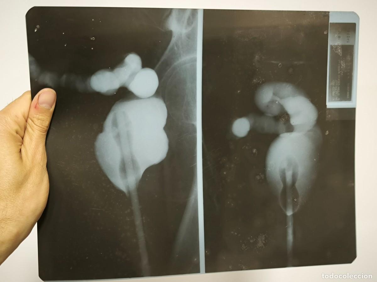 Oggetti Antichi: Radiograf&iacute;a M&eacute;dica Antigua Sistema Digestivo 30 X 24 Cm &ndash; Placa Doble De Estudio Interno