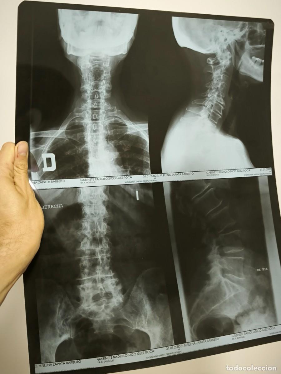 Antiquit&auml;ten: Radiograf&iacute;a M&eacute;dica Completa Columna Y Cervical &ndash; Placa Cl&iacute;nica Original Est&eacute;tica &Uacute;nica