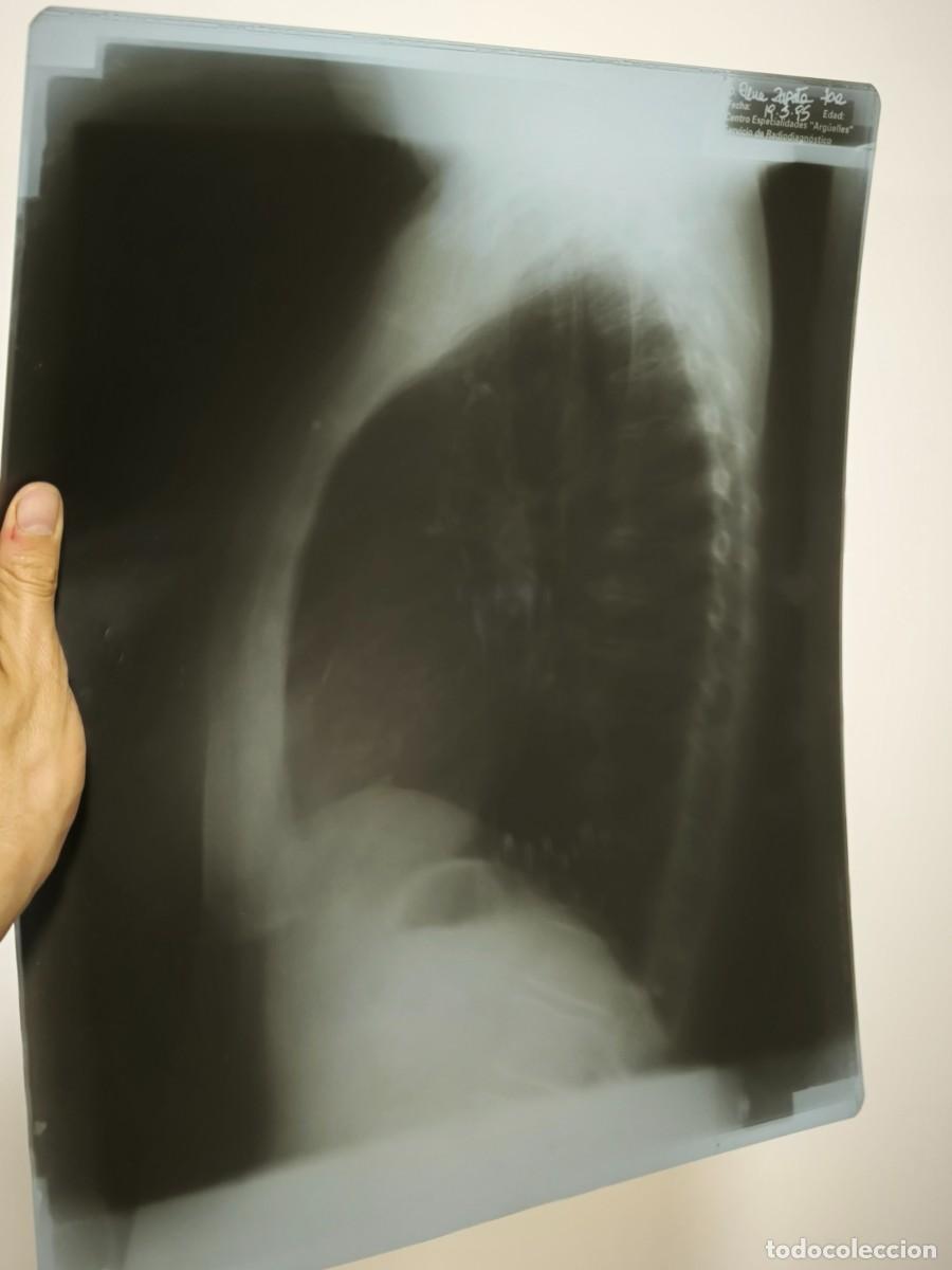 Antiquit&eacute;s: Radiograf&iacute;a Lateral De T&oacute;rax Original &ndash; Placa M&eacute;dica Aut&eacute;ntica Est&eacute;tica Cl&iacute;nica