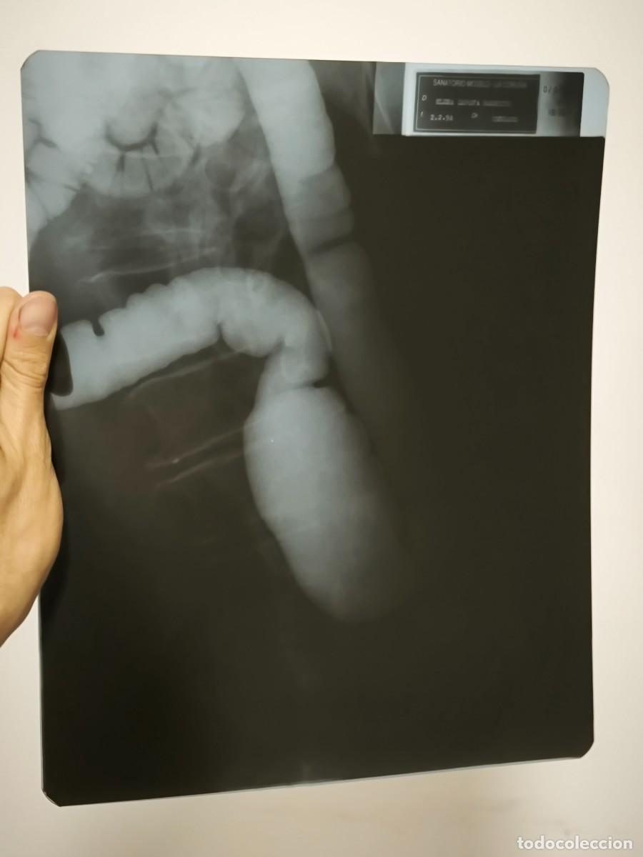 Antiquit&auml;ten: Radiograf&iacute;a M&eacute;dica Antigua 30x24 Cm &ndash; Placa Original Diagn&oacute;stico Vintage