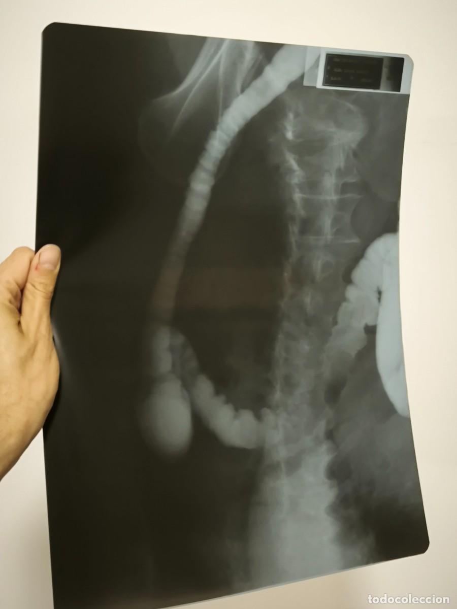 Antiquit&auml;ten: Radiograf&iacute;a M&eacute;dica Antigua Aparato Digestivo 40x30 Cm &ndash; Placa Original Vintage