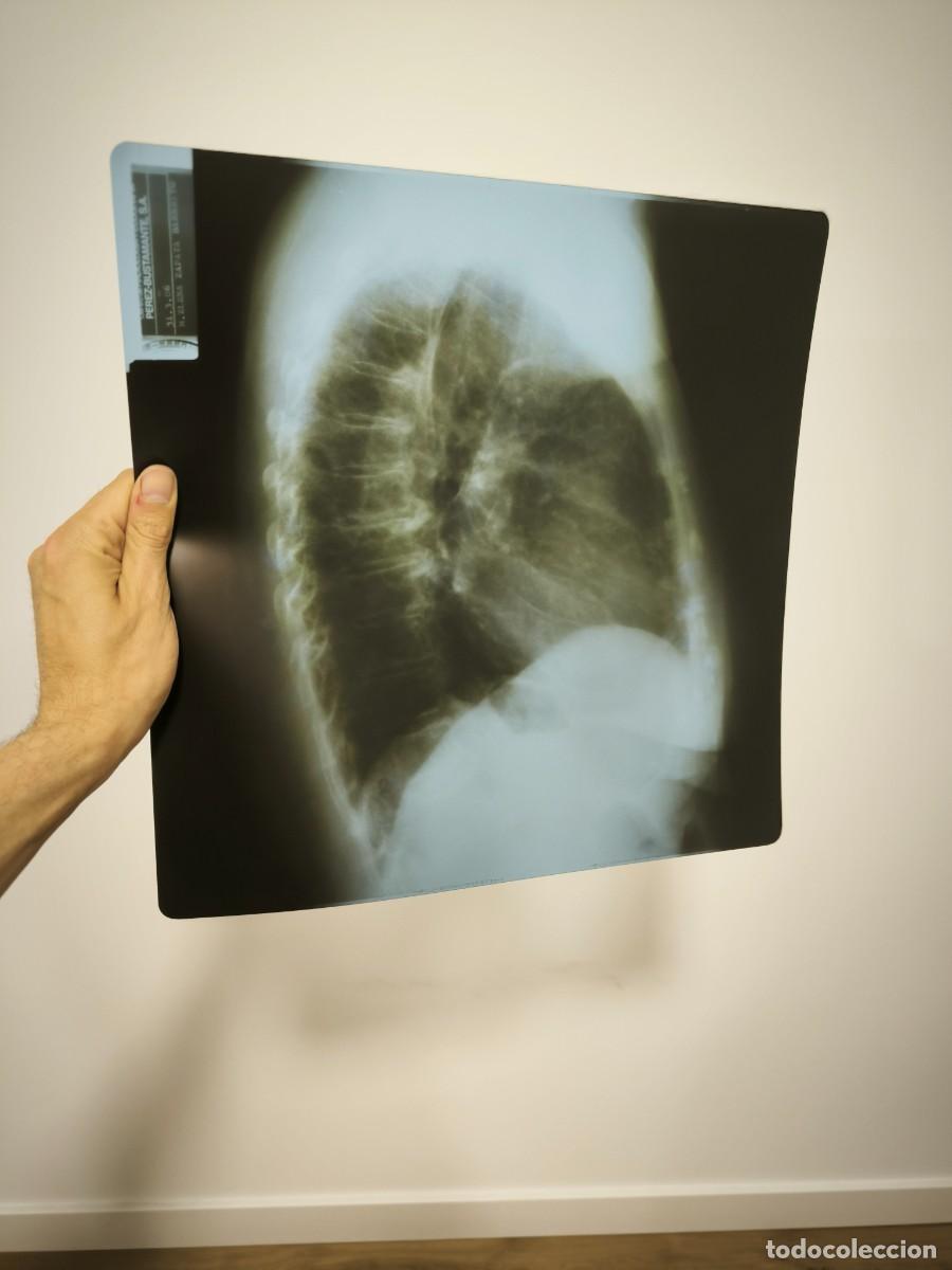 Antiques: Radiograf&iacute;a Antigua De T&oacute;rax 36x36 Cms &ndash; Placa M&eacute;dica Vintage Decoraci&oacute;n Industrial