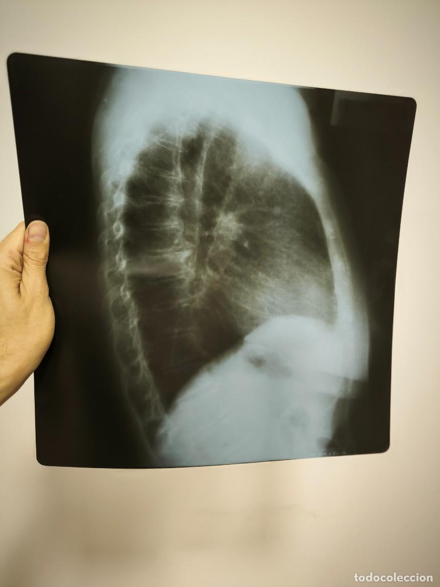 Antiguidades: Radiograf&iacute;a Antigua De T&oacute;rax 36x36 Cms &ndash; Placa M&eacute;dica Vintage Est&eacute;tica Cl&aacute;sica