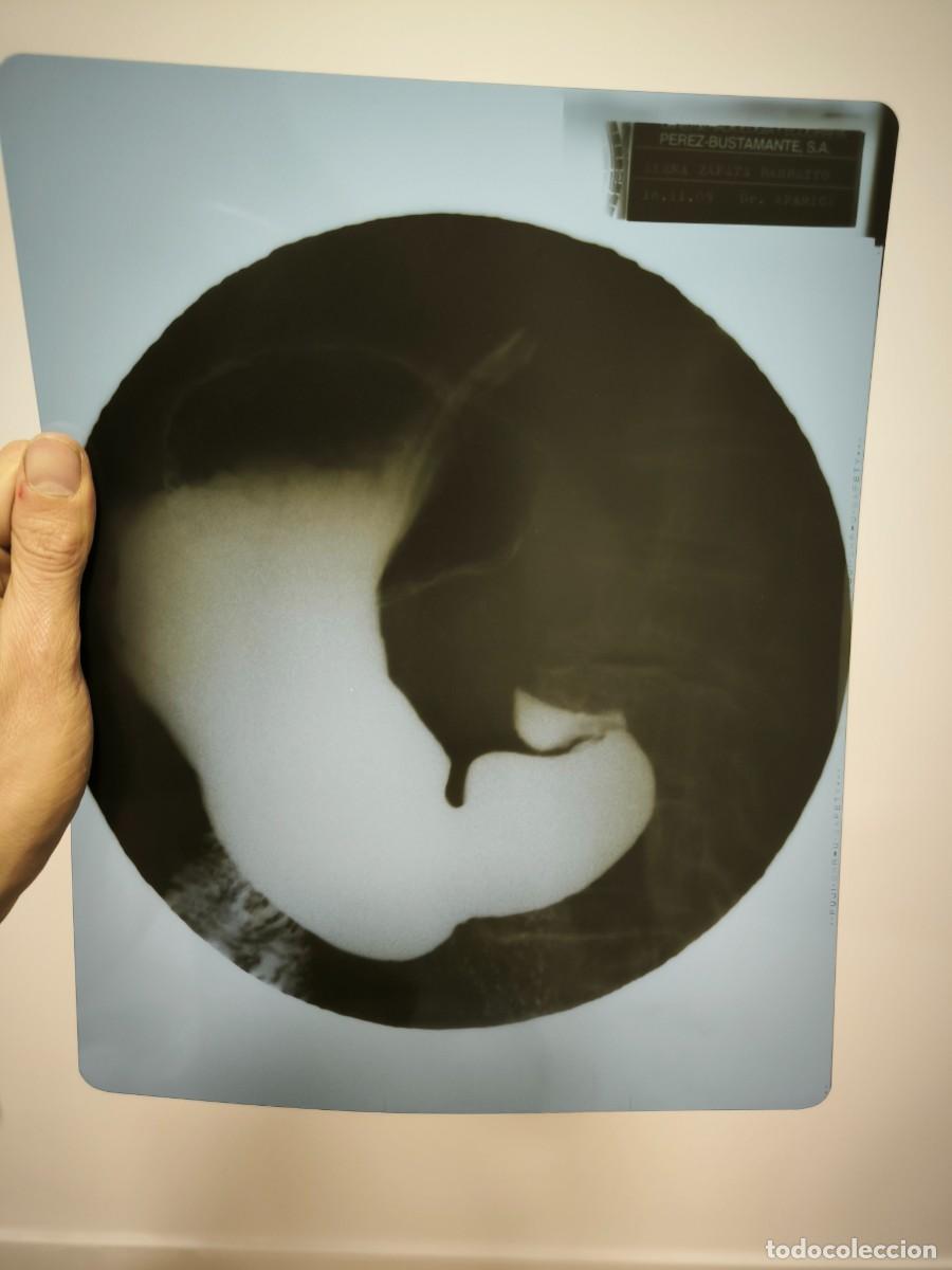 Antiques: Radiograf&iacute;a M&eacute;dica Antigua De Est&oacute;mago &ndash; Placa Original Vintage 30x24 Cms