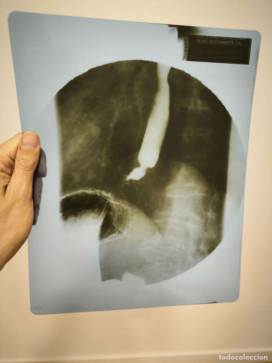 Antiquit&auml;ten: Radiograf&iacute;a M&eacute;dica Antigua De Es&oacute;fago Y T&oacute;rax &ndash; Placa Original Vintage 30x24 Cms