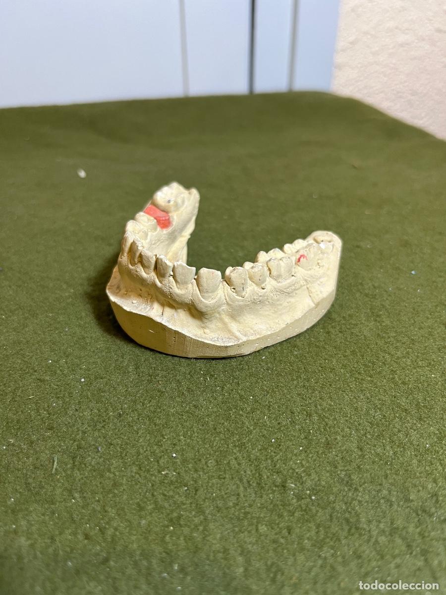 Oggetti Antichi: Antiguo molde dental de escayola para pr&oacute;tesis u ortodoncia &ndash; Arcada inferior &ndash; Laboratorio odontol&oacute;