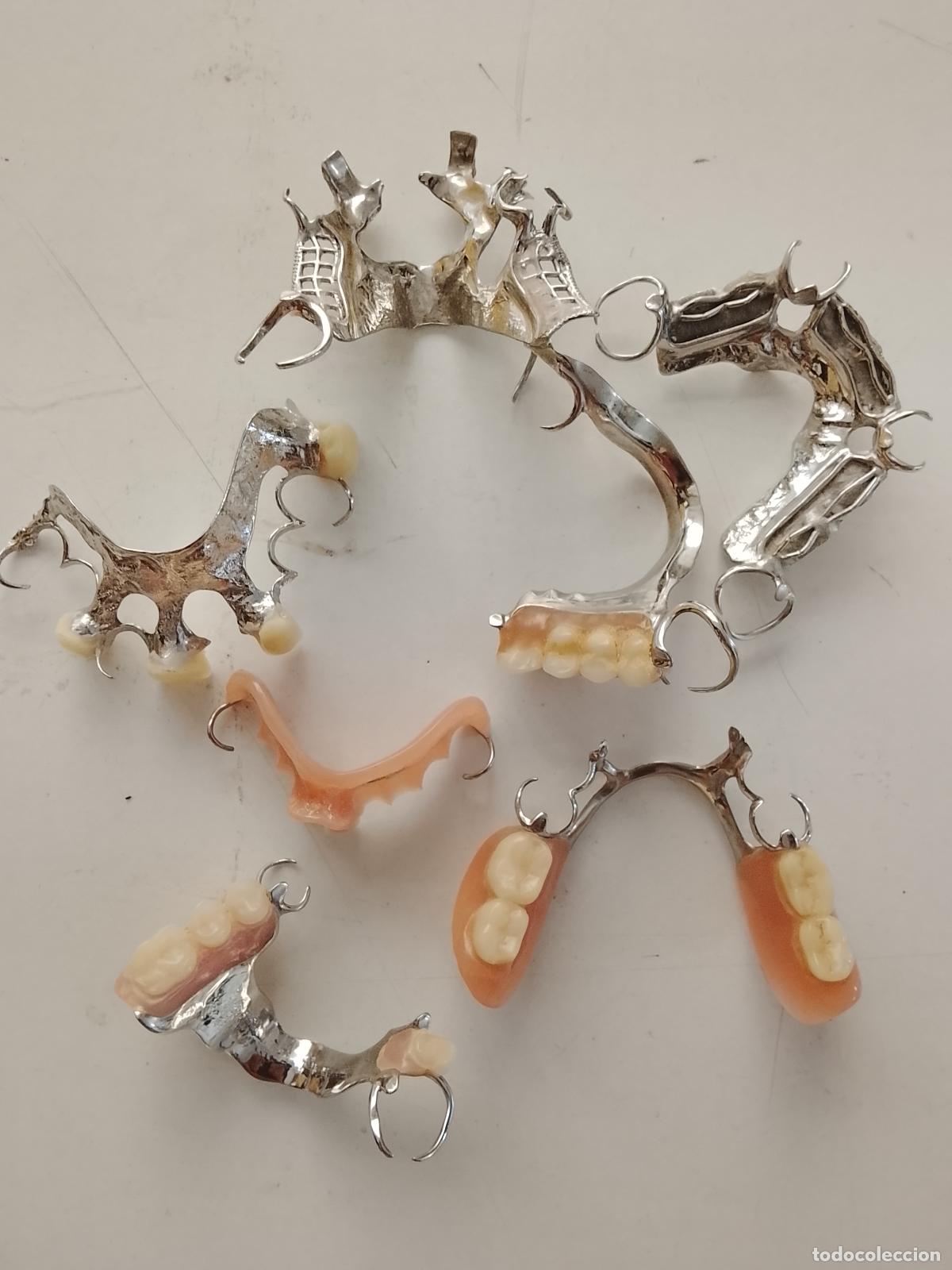 Antig&uuml;edades: DENTADURAS PROTESIS DENTAL ANTIGUAS ORIGINALES DE TALLER PROTESICO DENTAL METALES NOBLES . VER