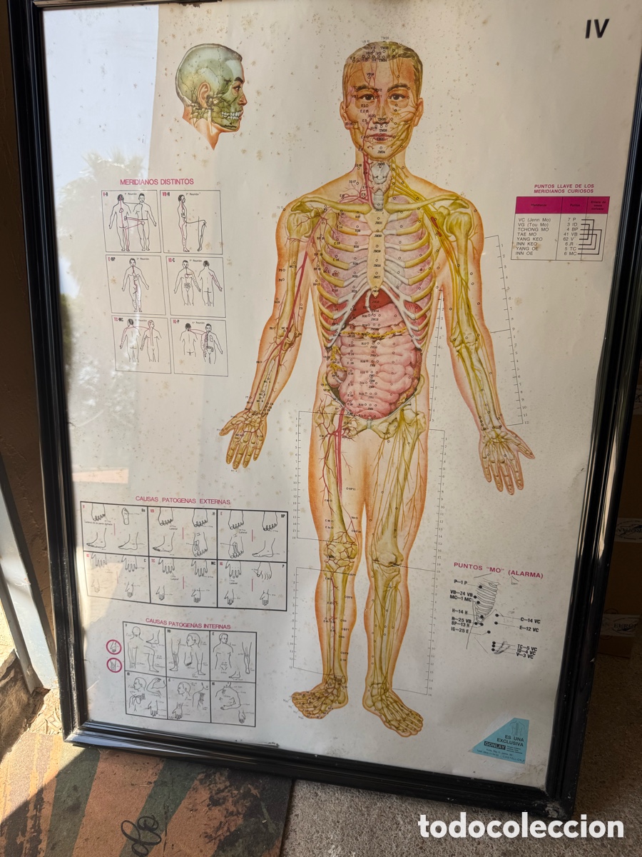 Antig&uuml;edades: Antigua lamina medica escolar de Gonlay!