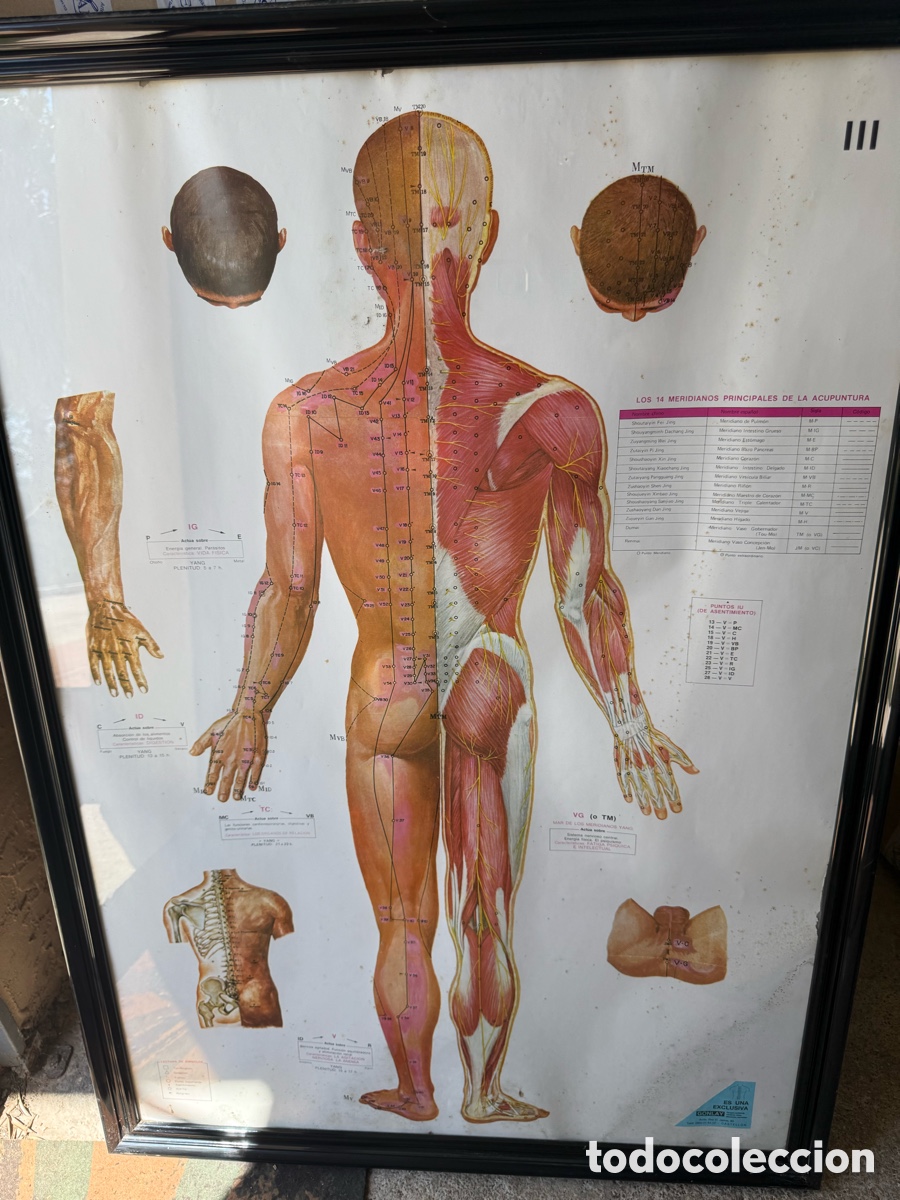 Antig&uuml;edades: Antigua lamina medica,escolar de Gonlay!Acopuntura!