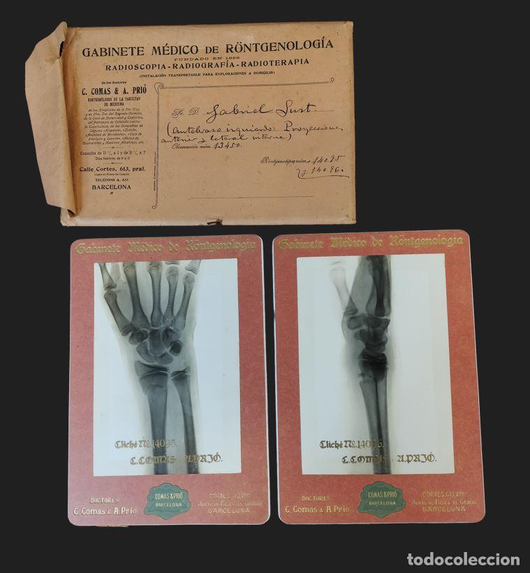 Antig&uuml;edades: PAREJA DE ANTIGUAS RADIOGRAF&Iacute;AS DE ANTEBRAZO. COMAS & PRI&Oacute;. SOBRE CARTR&Oacute;N. ESPA&Ntilde;A. C. 1910