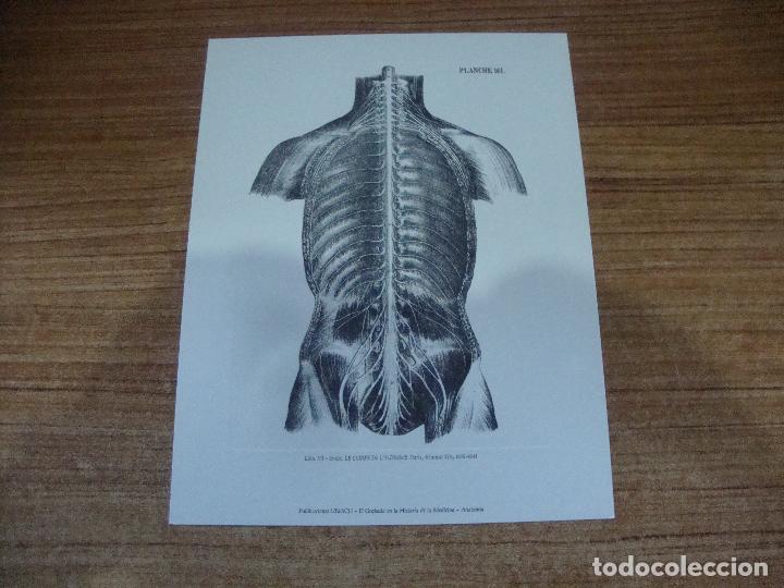 Art: GRABADO CIRUGIA EL GRABADO EN LA HISTORIA DE LA MEDICINA PUBLICACIONES URIACH LAMINA VI