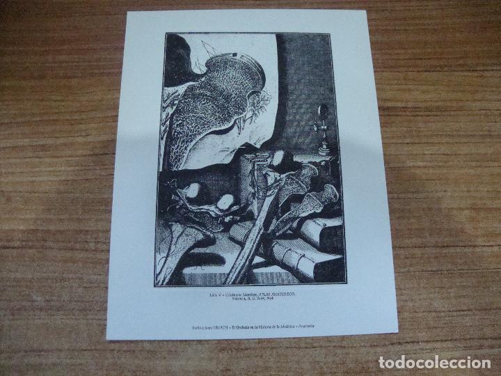 Art: GRABADO CIRUGIA EL GRABADO EN LA HISTORIA DE LA MEDICINA PUBLICACIONES URIACH LAMINA V