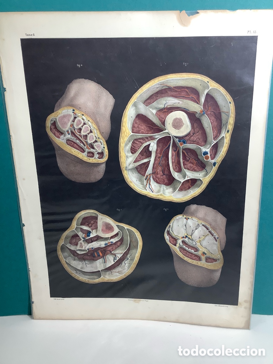 Arte: Grabado anat&oacute;mico en color de J.B. Bourgery