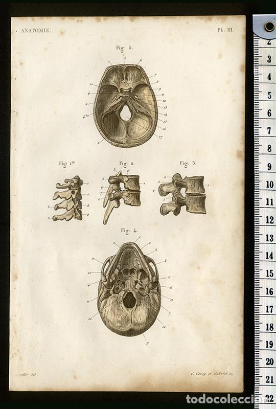Arte: PEQUE&Ntilde;O GRABADO ANAT&Oacute;MICO ILUMINADO, DE 1855: V&Eacute;RTEBRAS Y CR&Aacute;NEO. SISTEMA &Oacute;SEO. L&Eacute;VEILL&Eacute;. BOSSU