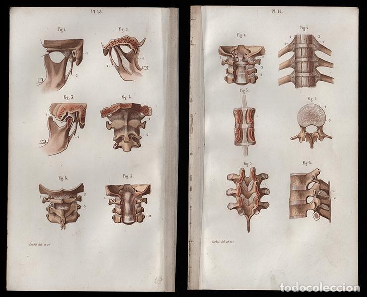 Arte: 2 PEQUE&Ntilde;OS GRABADOS COLOREADOS DE ANATOM&Iacute;A, 1850: ARTROLOG&Iacute;A. ARTICULACIONES V&Eacute;RTEBRAS, ETC. CORBI&Eacute;