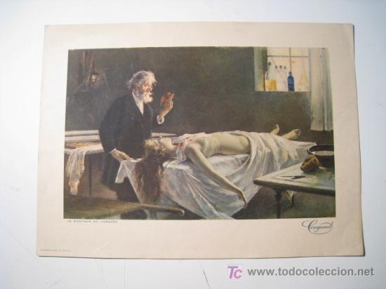 Arte: GRABADO LA ANATOMIA DEL CORAZON - CEREGUMIL - Foto 1