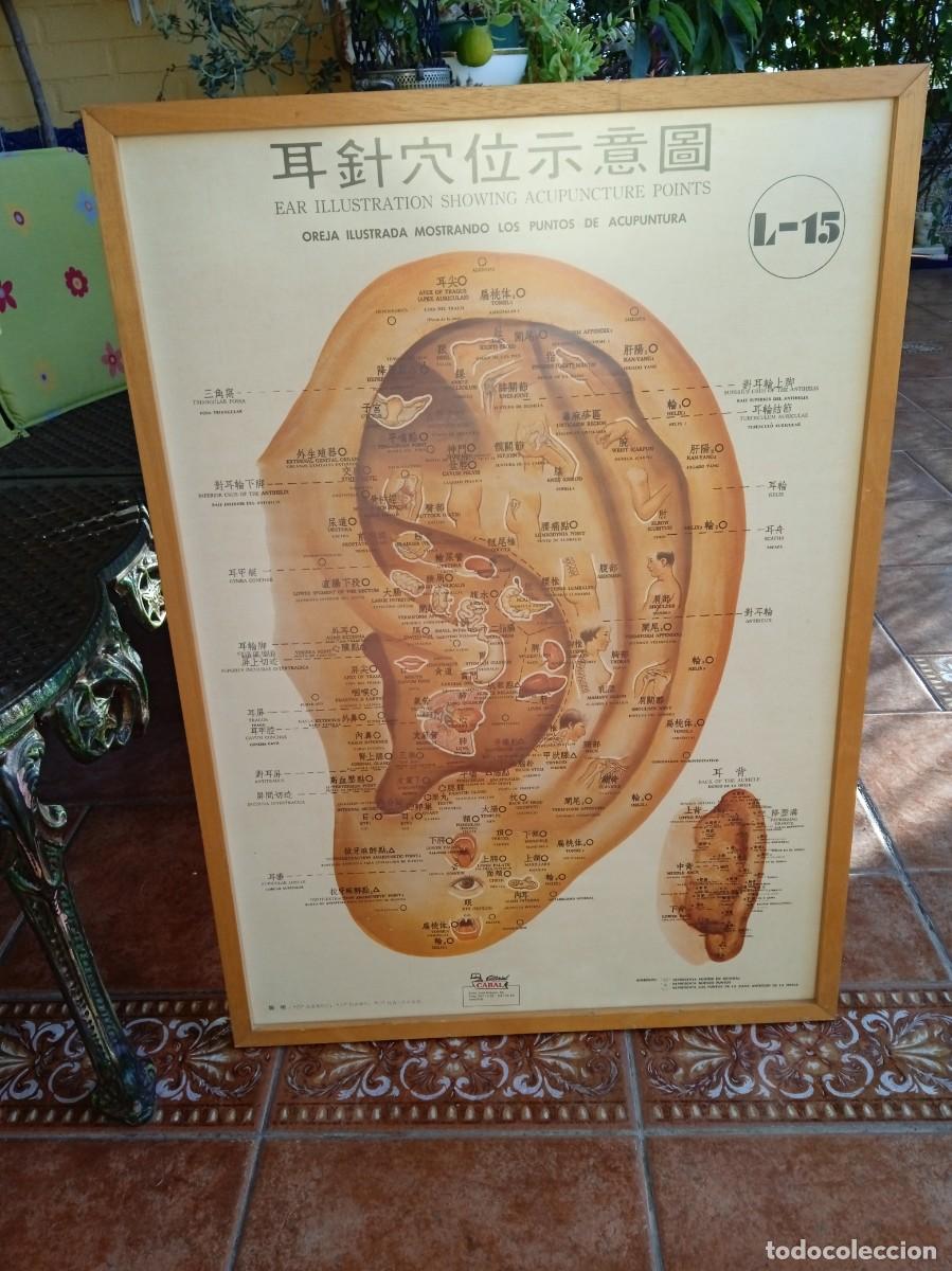 Arte: Cuadro antiguo vintage Acupuntura de oreja