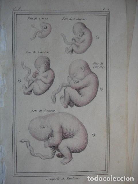 Arte: FETOS HUMANOS.COLOREADO A MANO  . A&Ntilde;O 1848