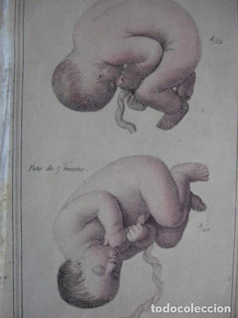 Arte: FETOS HUMANOS.COLOREADO A MANO . A&Ntilde;O 1848