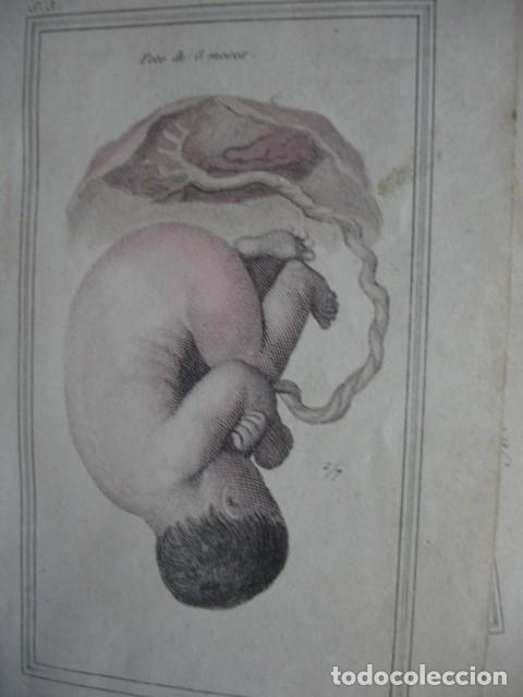 Arte: FETOS HUMANOS 8 MESES .COLOREADO A MANO . A&Ntilde;O 1848