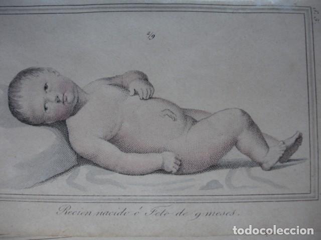 Arte: FETOS HUMANOS RECIEN NACIDO  .COLOREADO A MANO . A&Ntilde;O 1848