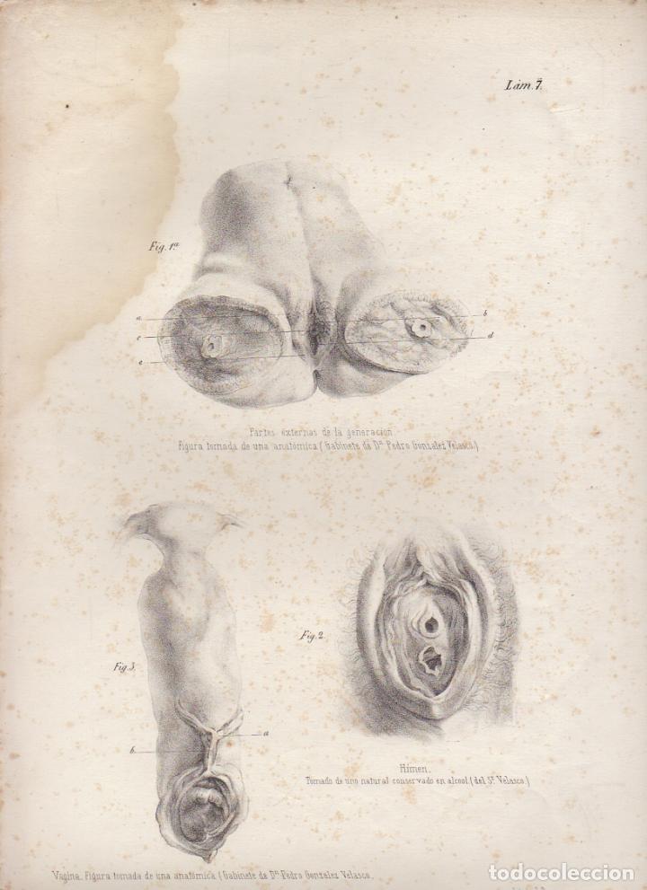 Art: LITOGRAFIA DE MEDICINA. VAGINA. FIGURA TOMADA DE UNA ANATOMICA. LAM. 7&ordf;. LIT. DE DONON G-MEDICA-009