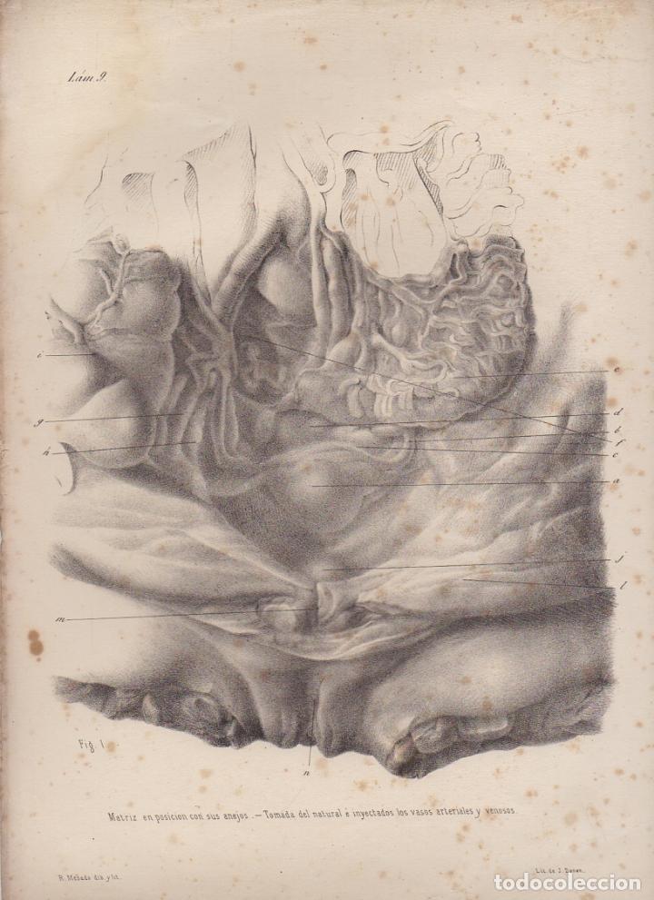 Art: LITOGRAFIA DE MEDICINA. MATRIZ EN POSICION CON SUS ANEJOS. LAMINA 9&ordf;. LIT. DE DONON G-MEDICA-010