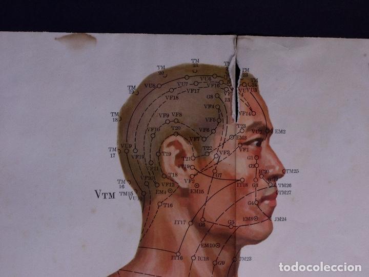 Carteles: POSTER DE ACUMPURA CHINO - Foto 4