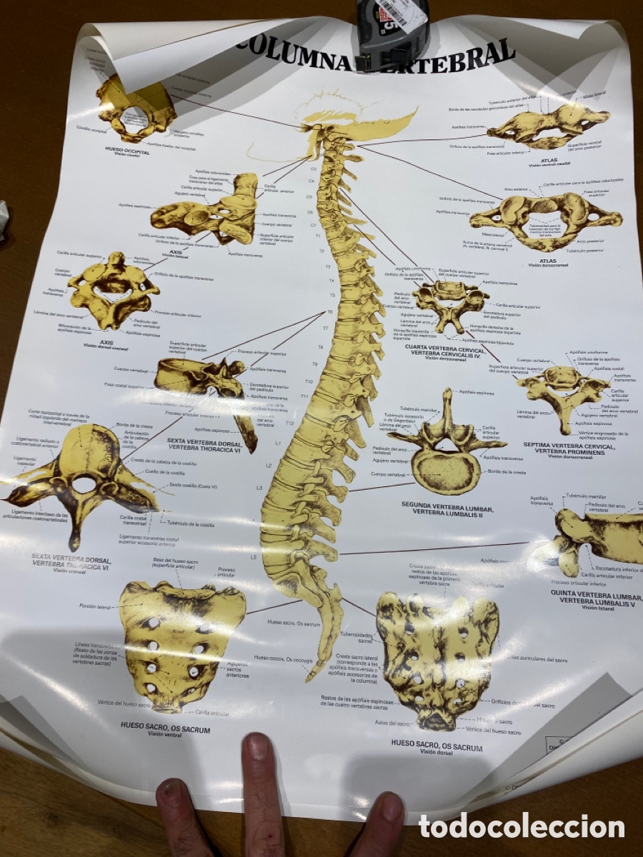 Carteles: Cartel Medco de la columna vertebral - Foto 4