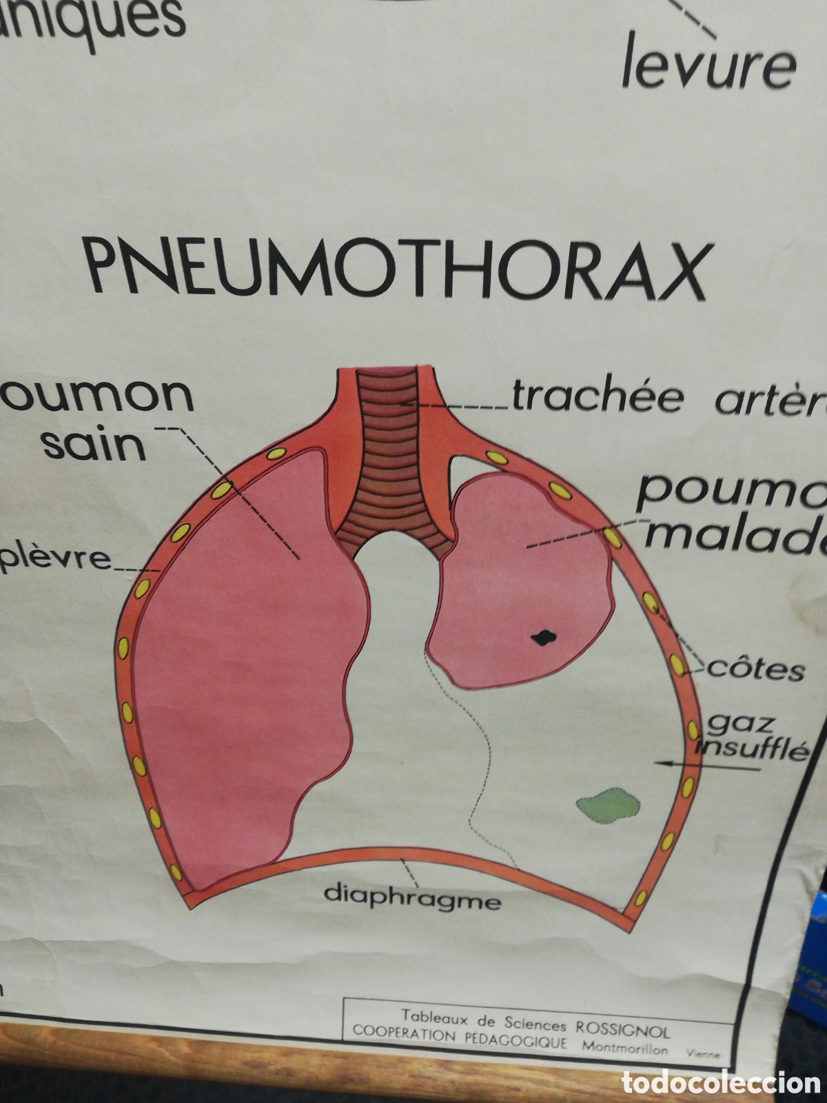 Carteles: Cartel Pulmones. En Franc&eacute;s. - Foto 14