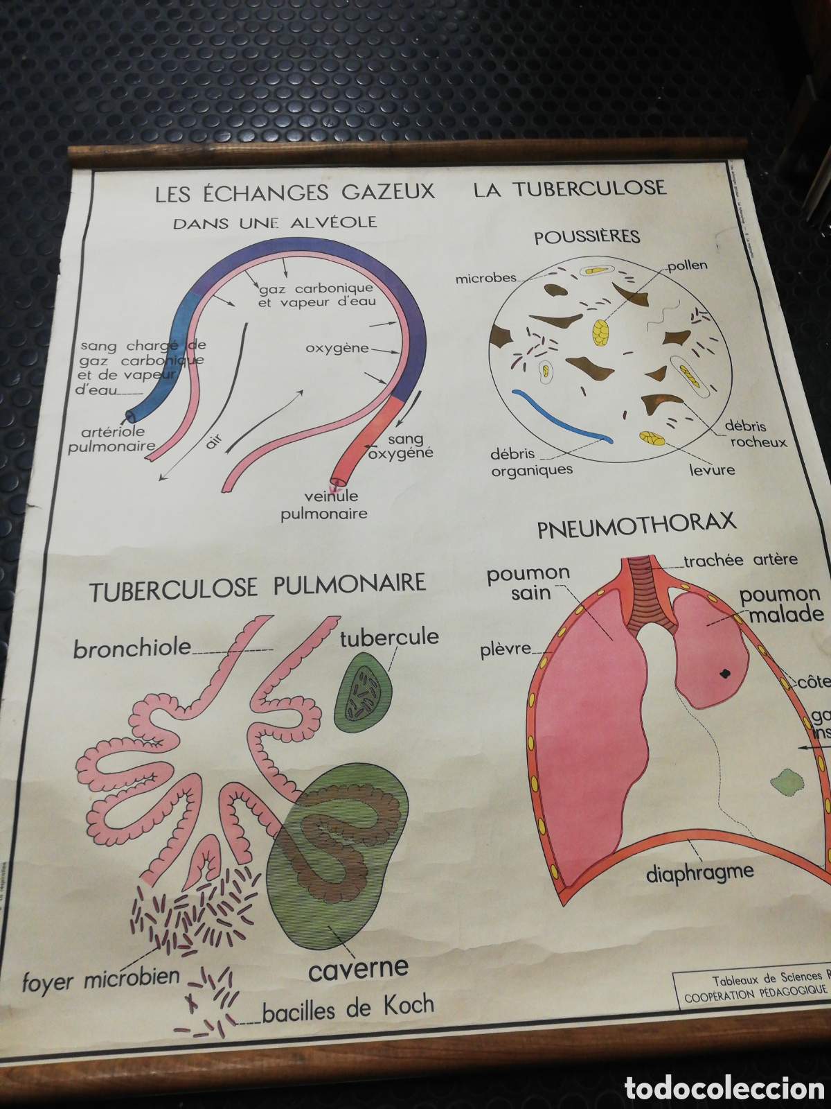 Carteles: Cartel Pulmones. En Franc&eacute;s. - Foto 1