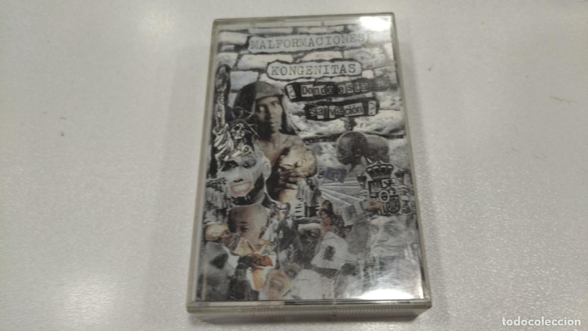 Old Cassettes: XMOSTRADOR- Malformaciones Kong&eacute;nitas - &iquest;Donde Esta Mi Salvaci&oacute;n? (Cass)