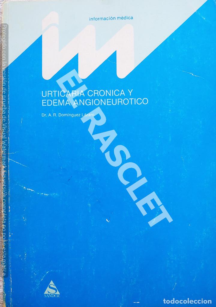 Catalogues publicitaires: CATALOGO MEDICO - URTICARIA CRONICA IY EDEMA ANGIONEUROTICO