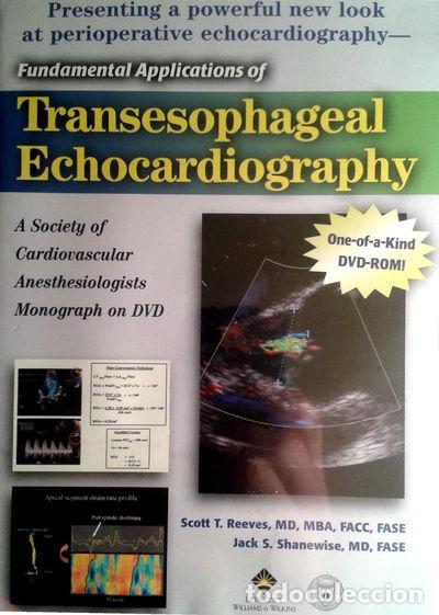 Cinema: Fundamental Applications of Transesophageal Echocardiography- 9781582557618