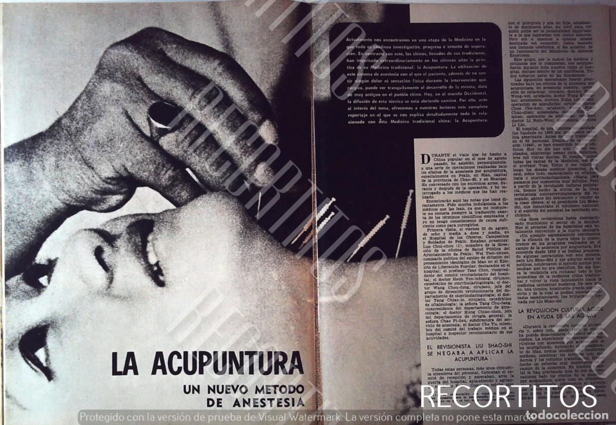 Cin&eacute;ma: LA ACUPUNTURA CHINA EN ESPA&Ntilde;A 1972