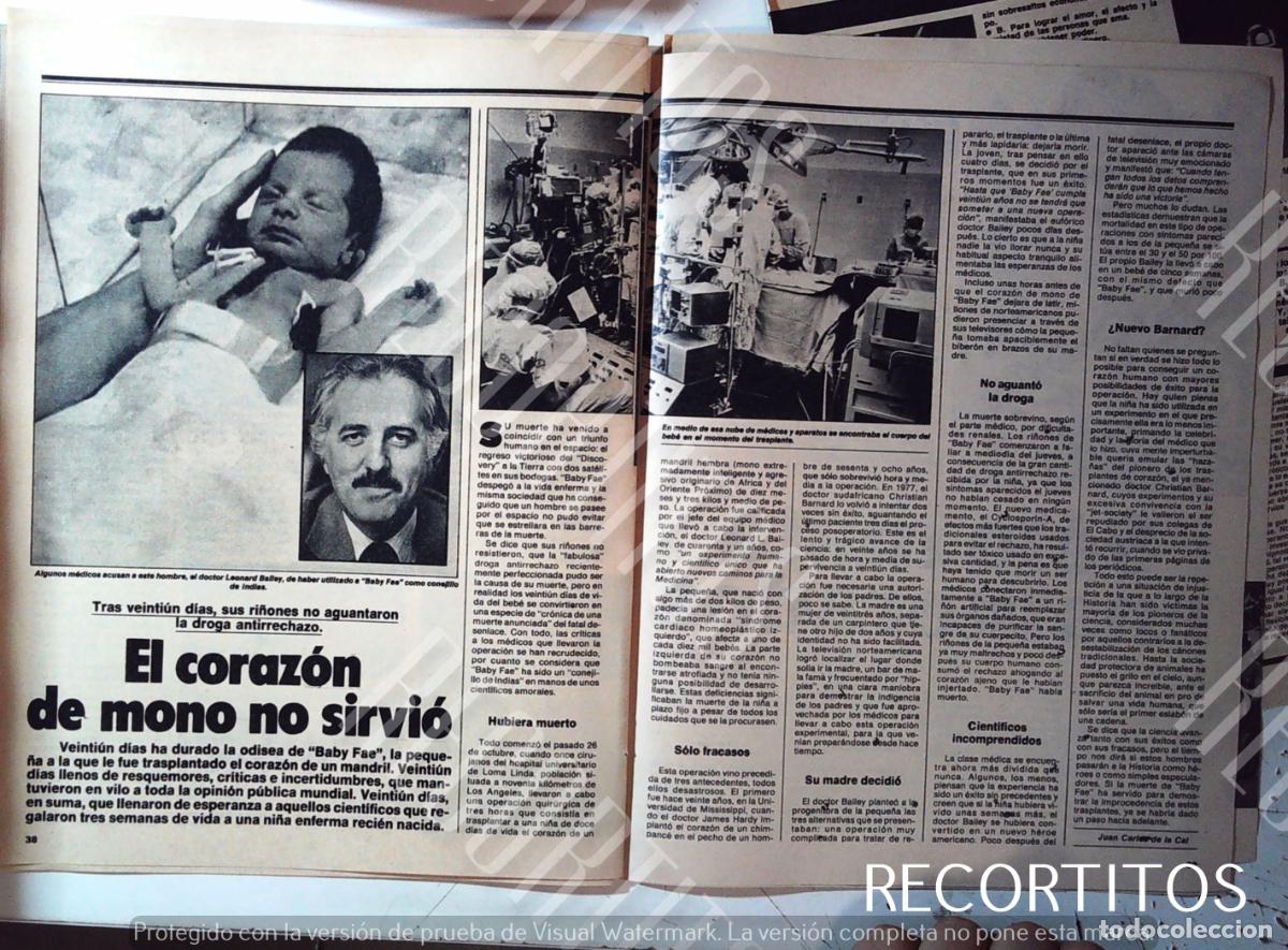 Cine: leonard balley fallido transplante de corazon de mono a un bebe