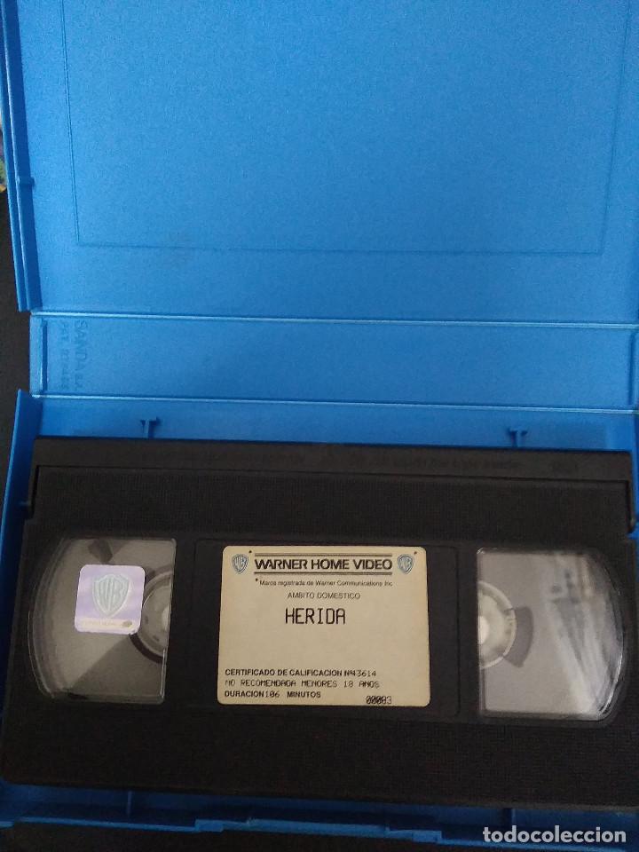 Peliculas: HERIDA - Foto 3