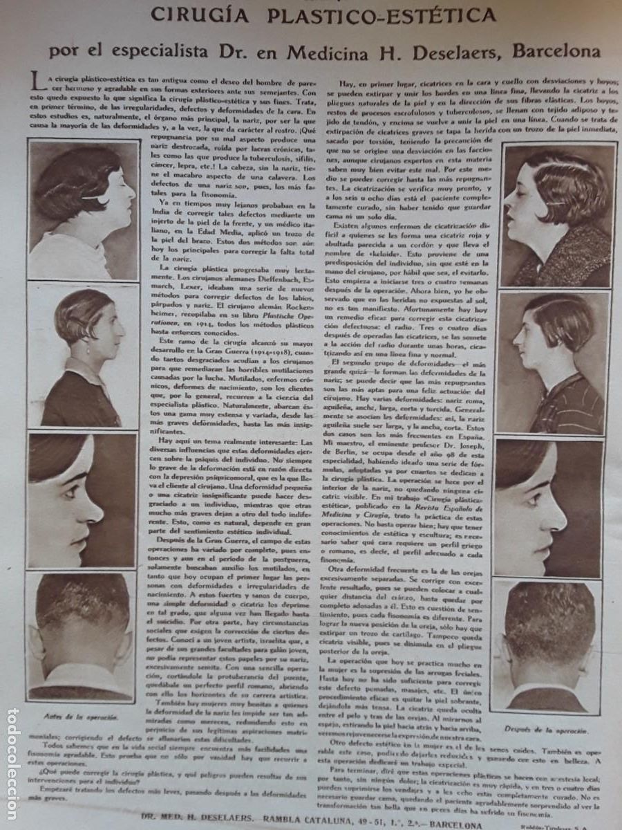 Colecionismo de cartazes: CIRUGIA PLASTICO ESTETICA DOCTOR DESELAERS BARCELONA ANTES Y DESPUES OPERACION HOJA A&Ntilde;O 1929