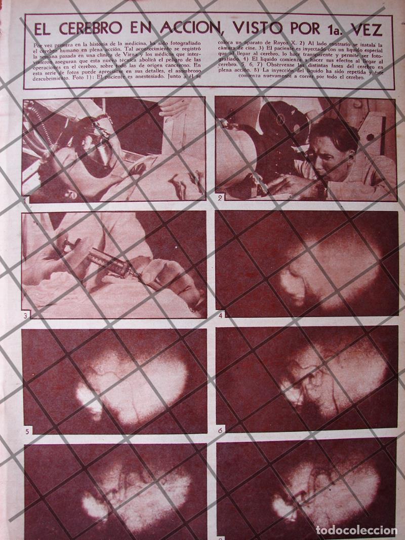 Poster collecting: AFICHE ANTIGUO LA 1RA RADIOGRAFIA DEL CEREBRO FUNCIONANDO