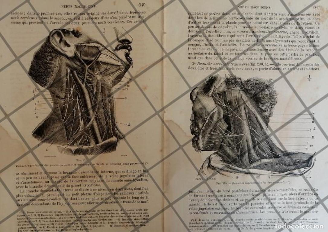 Collezionismo di affissi: GRABADO MEDICO ANTIGUO 1877 NERVIOS CUELLO /04