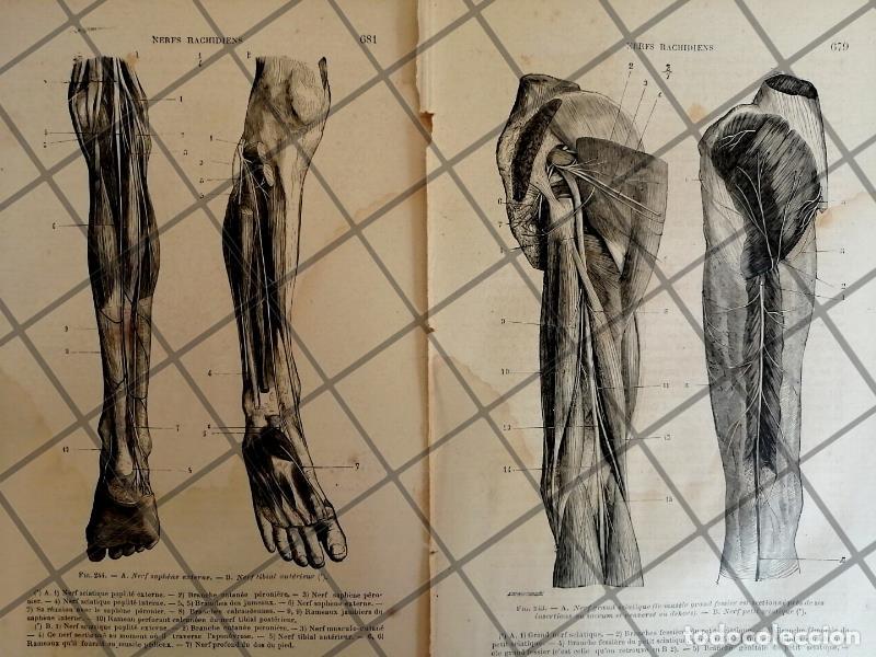 Collezionismo di affissi: GRABADO MEDICO ANTIGUO 1877 NERVIOS DE LAS PIERNAS /07
