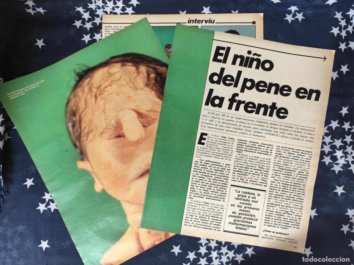 Coleccionismo de revista Intervi&uacute;: El ni&ntilde;o del pene en la frente Recorte/Cliping Revista Interviu 336-1982