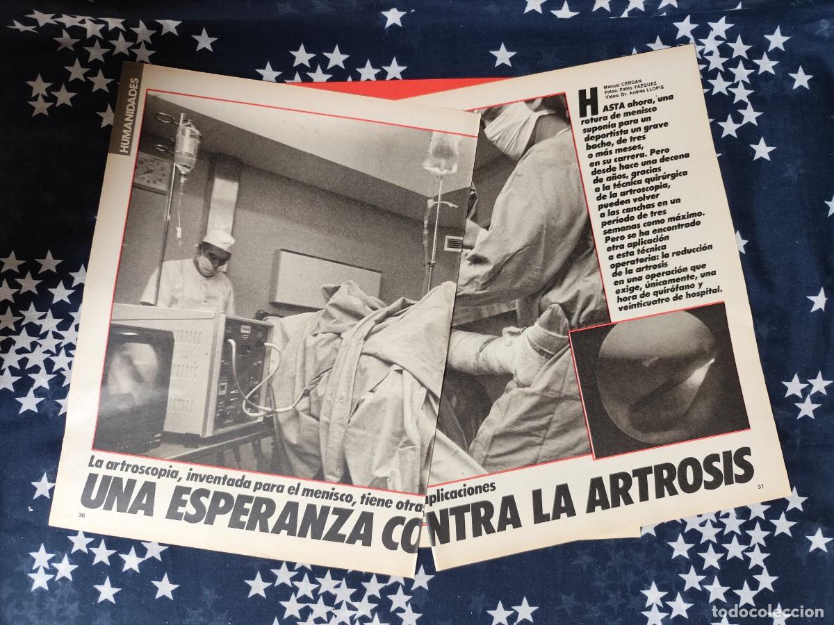 Coleccionismo de revista Intervi&uacute;: Una esperanza contra la artrosis Recorte/Cliping Revista Interviu 503 1985
