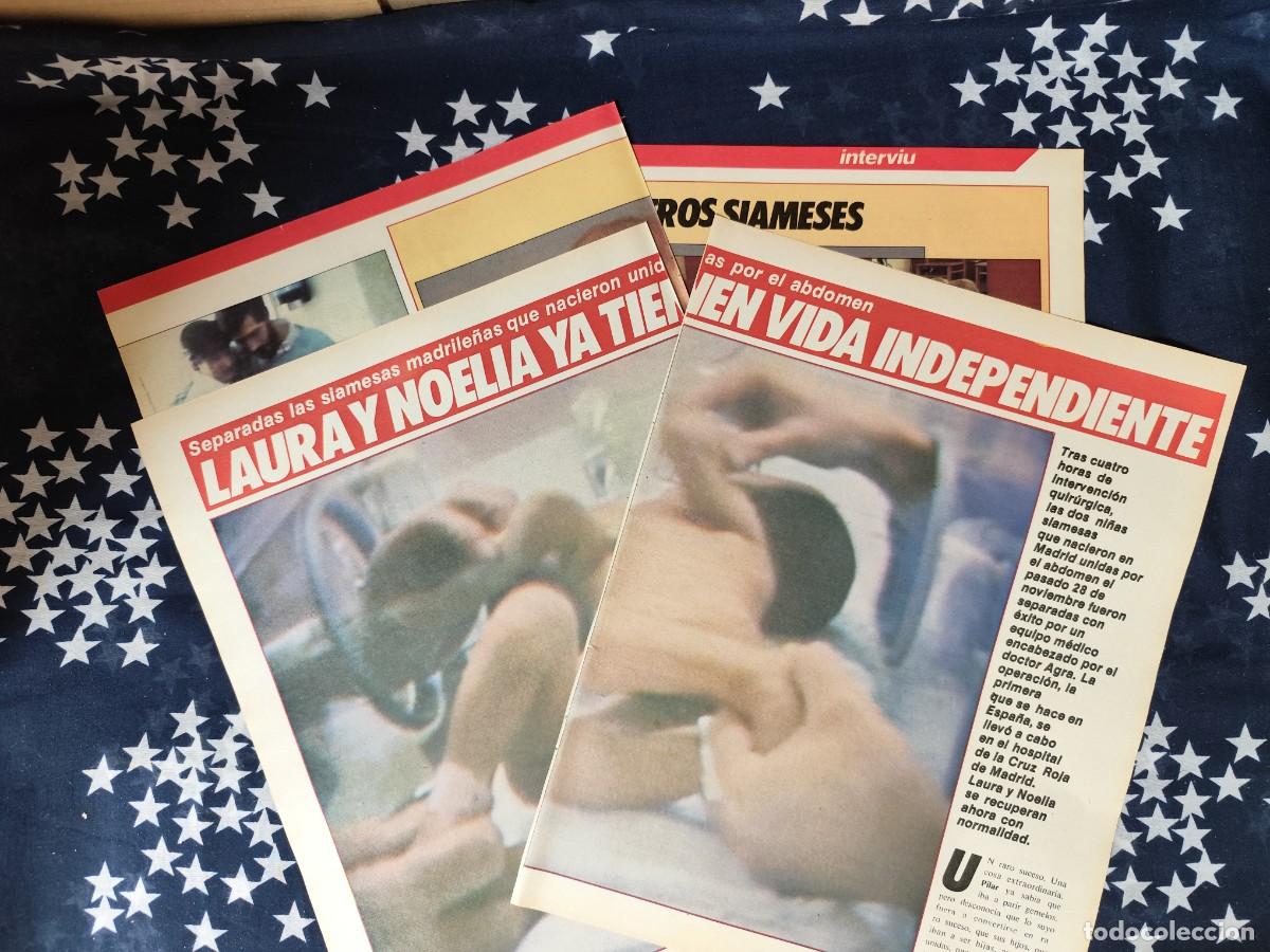 Coleccionismo de revista Intervi&uacute;: Las siamesas Laura y Noelia ya tienen vida independiente Recorte/Cliping Revista Interviu 501 1985