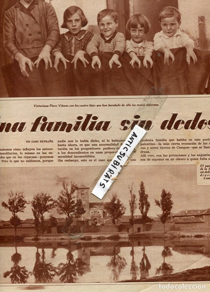 Collection Magazines and Newspapers: REVISTA 1933 MALFORMACIONES FAMILIA SIN DEDOS DE PEDRAZA VALDELATEJA BURGOS SAN PEDRO DE MANRIQUE