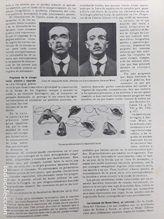 Collezionismo di Riviste e Giornali: CIRUGIA FACIAL PLATICA Y REPARADORA PROCEDIMIENTO DERWENT WOOD PIEZAS PROTESICAS REVISTA A&Ntilde;O 1919