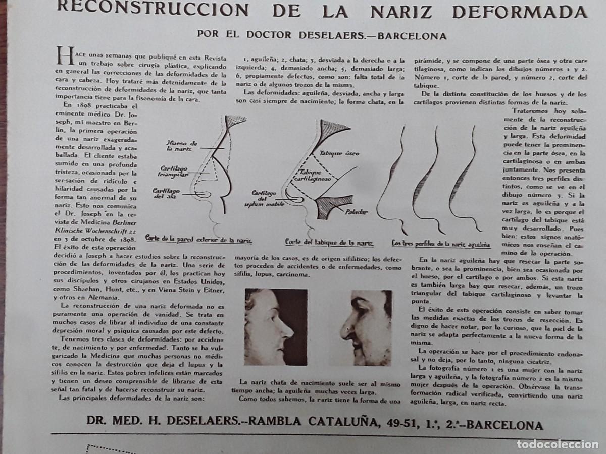 Collection Magazines and Newspapers: RECONSTRUCCION DE LA NARIZ DEFORMADA DOCTOR H.DESELAERS BARCELONA HOJA A&Ntilde;O 1929
